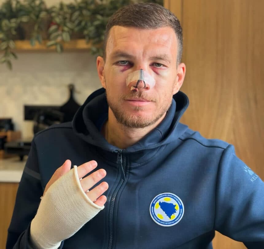 Edin Džeko Shares Emotional Message About Bosnia After Injury